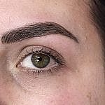 microlading montpellier avant apres missdelph beaute