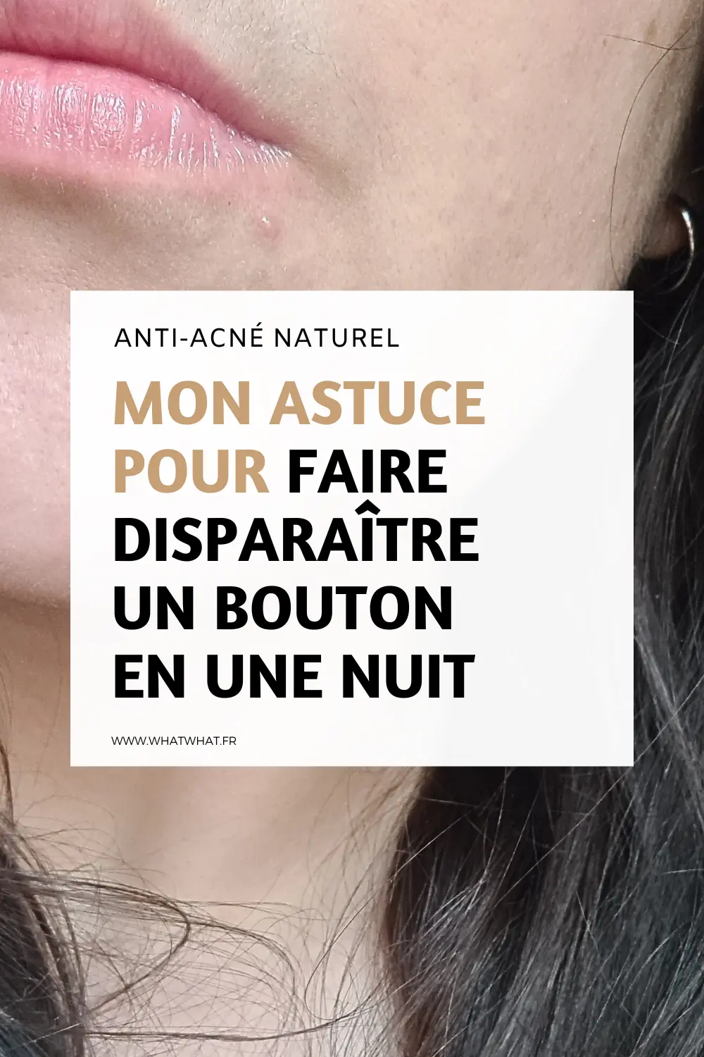 Mon astuce pour faire disparaître un bouton en une nuit